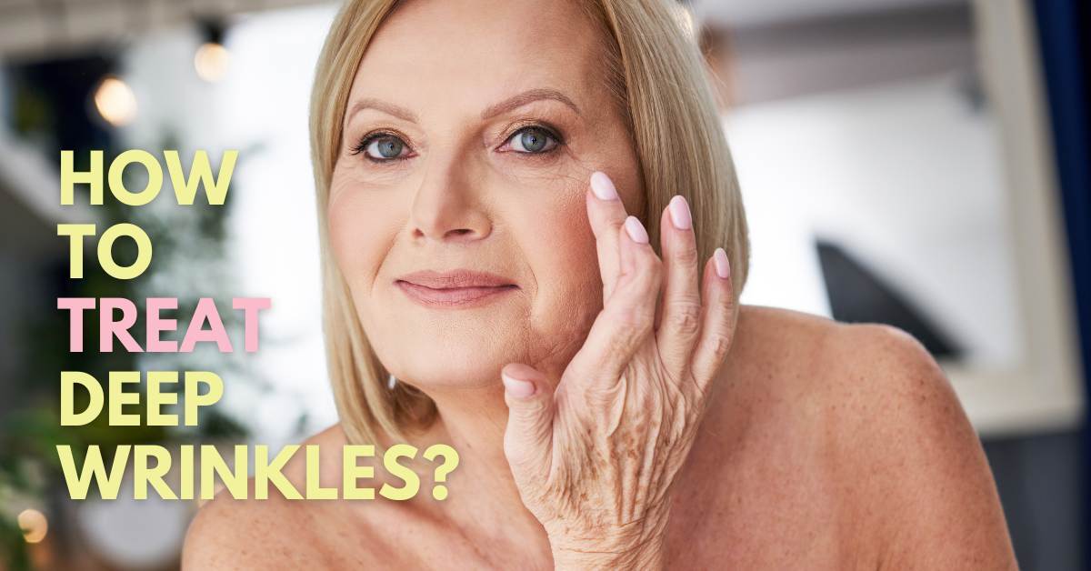 Deep Creases Your Essential Guide to the Best Treatment for Deep Wrinkles on Face ...